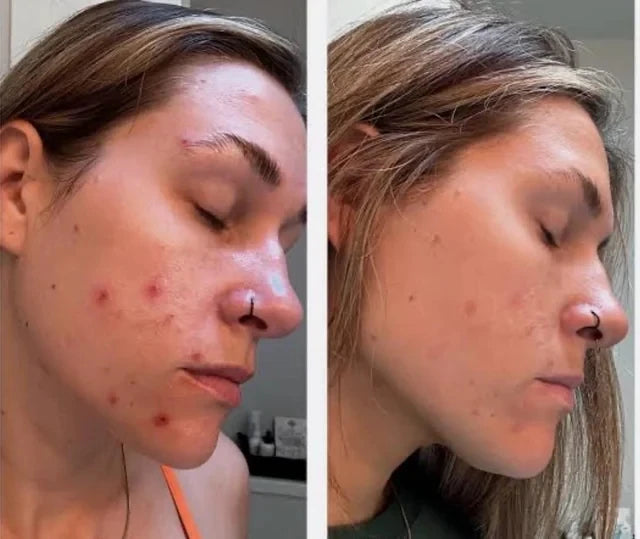 Beef Tallow Face Cream – Long-Lasting Moisturizing