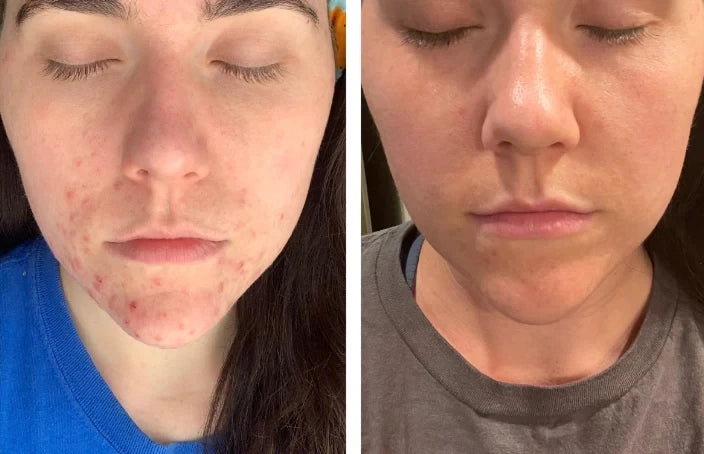 Beef Tallow Face Cream – Long-Lasting Moisturizing